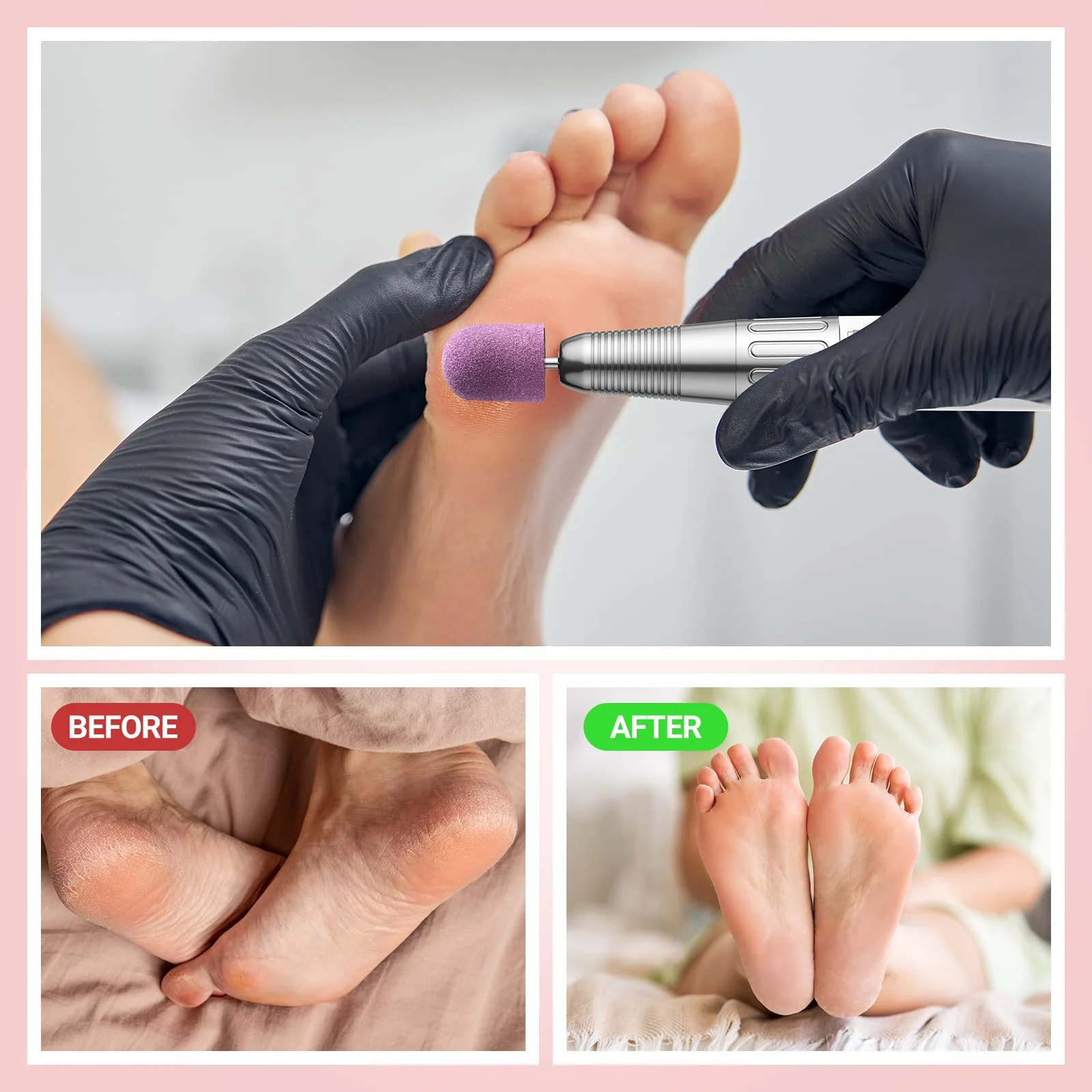 Nail Sanding Caps With A Rubber Mandrel Bit Purple - 13mm - Image 4
